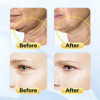 NeckGlow LED Therapy Device | Tech Neck Fix