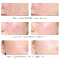 YP GlowPeak LED Mask