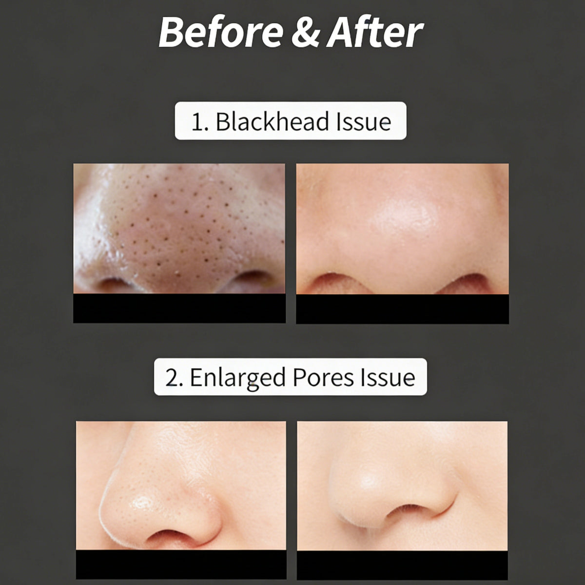 AquaGlow Pore Cleanser Tool | Pore Cleansing